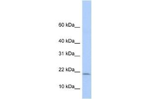 POLR1D antibody used at 1 ug/ml to detect target protein. (POLR1D antibody)