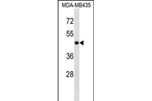 PK3 Antibody (ABIN1539804 and ABIN2843791) western blot analysis in MDA-M cell line lysates (35 μg/lane). (ERK1 antibody)