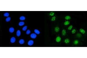 IF analysis of DHODH using anti-DHODH antibody (ABIN7603140).