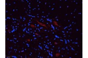 Expression of P2RX5 in rat spinal cordImmunohistochemical staining of rat spinal cord frozen section using Anti-P2X5 Receptor Antibody (ABIN7581933), (1:100).