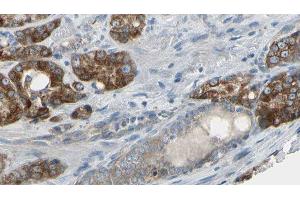 ABIN6279443 at 1/100 staining Human prostate tissue by IHC-P.