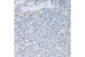 Immunohistochemistry of paraffin-embedded rat spleen using SFN Antibody. (14-3-3 sigma/SFN antibody  (AA 1-248))