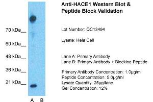 Host: Rabbit  Target Name: HACE1  Sample Tissue: Hela Whole cell  Lane A:  Primary Antibody Lane B: Primary Antibody + Blocking Peptide Primary Antibody Concentration: 1 µg/mL Peptide Concentration: 5 µg/mL Lysate Quantity: 41 µg/lane/LaneGel Concentration:. (HACE1 antibody  (Middle Region))