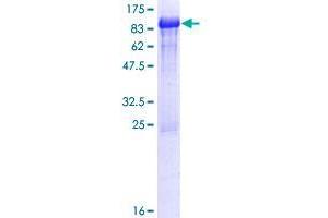 FETUB Protein (AA 1-382) (GST tag)