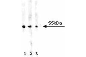 Western blot analysis of ALDH on A431 cell lysate. (Aldehyde Dehydrogenase antibody  (AA 7-128))