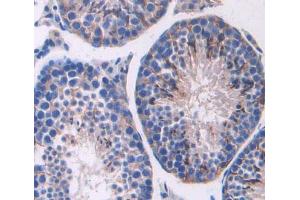 Used in DAB staining on fromalin fixed paraffin- embedded testis tissue (ABCC11 antibody  (AA 1127-1366))