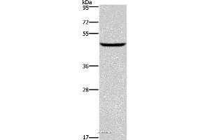 Western blot analysis of Human testis tissue, using DMRT3 Polyclonal Antibody at dilution of 1:550 (DMRT3 antibody)