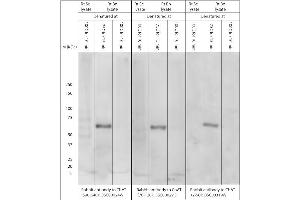 Effect of denaturing temperature on Western blot on brain lysates using Rabbit antibody to ChAT (70-120): . (Choline Acetyltransferase antibody)