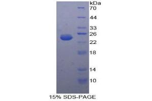SDS-PAGE analysis of Human cPLA2 Protein.