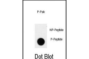 Dot blot analysis of anti-Phospho-ACK1-p Phospho-specific Pab (ABIN650839 and ABIN2839804) on nitrocellulose membrane. (TNK2 antibody  (pTyr826))
