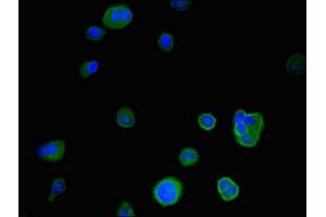 Immunofluorescent analysis of MCF-7 cells using ABIN7167054 at dilution of 1:100 and Alexa Fluor 488-congugated AffiniPure Goat Anti-Rabbit IgG(H+L) (IER3 antibody  (AA 1-82))
