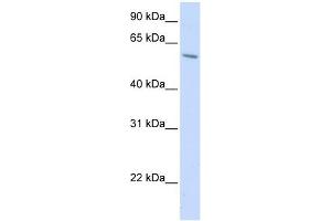 PORCN antibody used at 1 ug/ml to detect target protein. (PORCN antibody)