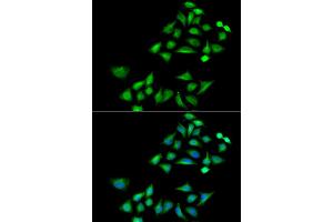 Immunofluorescence analysis of A549 cells using KLK4 antibody (ABIN5973996). (Kallikrein 4 antibody)