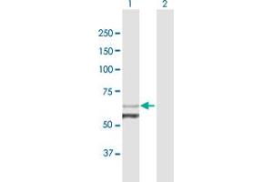 Western Blot analysis of FGD5 expression in transfected 293T cell line by FGD5 MaxPab polyclonal antibody. (FGD5 antibody  (AA 1-540))