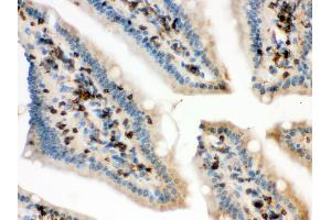 Anti- Cofilin Picoband antibody, IHC(P) IHC(P): Mouse Intestine Tissue (Cofilin antibody  (C-Term))