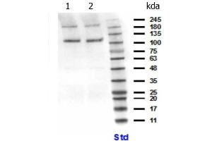 Western Blotting (WB) image for anti-Phosphoinositide-3-Kinase, Catalytic, beta Polypeptide (PIK3CB) (N-Term) antibody (ABIN5706834)