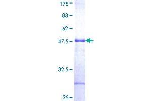 Image no. 1 for Aspartate beta-Hydroxylase (ASPH) (AA 161-270) protein (GST tag) (ABIN1345879) (Aspartate beta Hydroxylase Protein (AA 161-270) (GST tag))