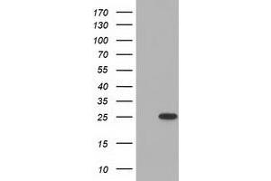 HEK293T cells were transfected with the pCMV6-ENTRY control (Left lane) or pCMV6-ENTRY MOBKL2B (Right lane) cDNA for 48 hrs and lysed. (MOBKL2B antibody)