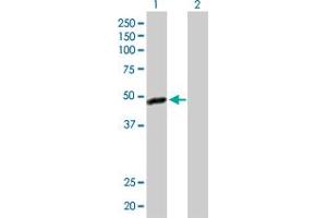 Western Blot analysis of C17orf75 expression in transfected 293T cell line by C17orf75 MaxPab polyclonal antibody. (C17orf75 antibody  (AA 1-396))