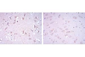 Immunohistochemical analysis of paraffin-embedded human brain tissues (left) and rat brain tissues (right) using GRIA3 mouse mAb with DAB staining. (Glutamate Receptor 3 antibody)