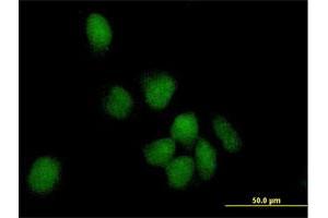 Immunofluorescence of purified MaxPab antibody to POLK on HeLa cell.