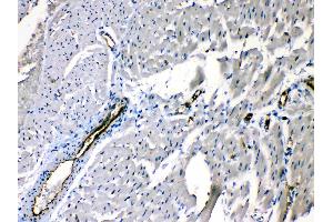 ANGPTL2 was detected in paraffin-embedded sections of rat cardiac muscle tissues using rabbit anti- ANGPTL2 Antigen Affinity purified polyclonal antibody (Catalog # ) at 1 µg/mL. (ANGPTL2 antibody  (Middle Region))