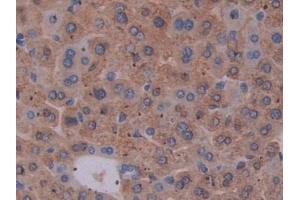 IHC-P analysis of Mouse Liver Tissue, with DAB staining. (EBI3 antibody  (AA 19-228))