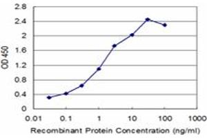 Detection limit for recombinant GST tagged SETDB1 is approximately 0. (SETDB1 antibody  (AA 2-100))