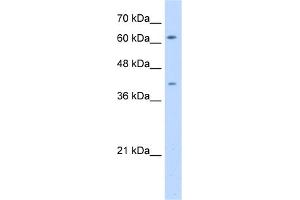 WB Suggested Anti-SWAP70 Antibody Titration:  5.