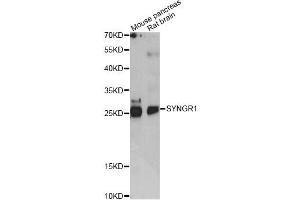 Western blot analysis of extracts of various cell lines, using SYNGR1 antibody (ABIN6290976) at 1:1000 dilution.