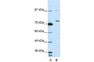 WB Suggested Anti-EXOSC10  Antibody Titration: 5. (EXOSC10 antibody  (C-Term))