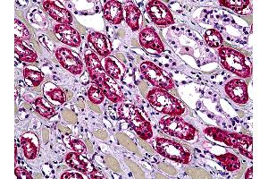 Anti-DHX9 antibody IHC of human kidney, tubules. (DHX9 antibody  (AA 1-91))