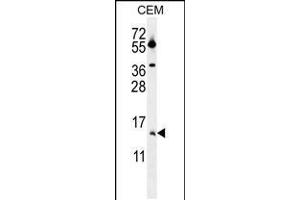 Western blot analysis in CEM cell line lysates (35ug/lane). (MGP antibody  (AA 37-66))