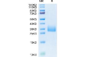 SDS-PAGE (SDS) image for Killer Cell Lectin-Like Receptor Subfamily B, Member 1 (KLRB1) (AA 67-227) protein (His tag) (ABIN7274090)