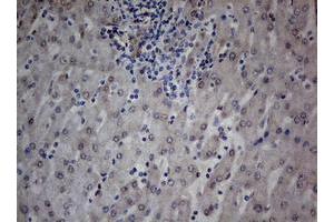 Image no. 2 for anti-TIA1 Cytotoxic Granule-Associated RNA Binding Protein (TIA1) antibody (ABIN1501387) (TIA1 antibody)