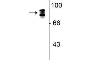 Western blot of rat lung lysate showing specific immunolabeling of the ~93 kDa periostin protein triplet. (Periostin antibody)