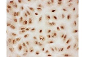 Immunocytochemistry (ICC) image for anti-Protein Inhibitor of Activated STAT, 1 (PIAS1) (AA 636-651) antibody (ABIN3032369)
