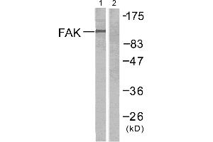 Western blot analysis of extracts from Jurkat cells untreated or treated with anti-CD3 antibody,using FAK (Ab-397) antibody (#B7081, Linand 2). (FAK antibody  (Tyr397))