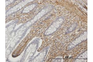 Immunoperoxidase of purified MaxPab antibody to CALD1 on formalin-fixed paraffin-embedded human small Intestine. (Caldesmon antibody  (AA 1-538))