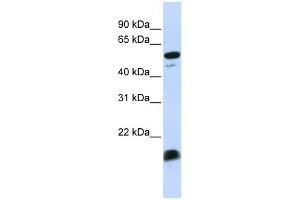 C4BPA antibody used at 1 ug/ml to detect target protein. (C4BPA antibody  (Middle Region))