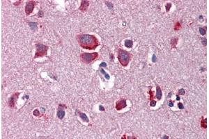 Immunohistochemistry (Formalin-fixed Paraffin-embedded Sections) (IHC (fp)) image for anti-Wingless-Type MMTV Integration Site Family, Member 7B (WNT7B) (AA 215-264) antibody (ABIN6747068)