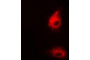 Immunofluorescent analysis of UGDH staining in HepG2 cells. (UGDH antibody)