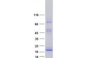 Western Blotting (WB) image for Thyroid Stimulating Hormone, beta (TSHB) protein (Myc-DYKDDDDK Tag) (ABIN2733689)