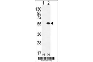 Western blot analysis of PRMT2 using rabbit polyclonal PRMT2 Antibody (L359) using 293 cell lysates (2 ug/lane) either nontransfected (Lane 1) or transiently transfected (Lane 2) with the PRMT2 gene. (PRMT2 antibody  (C-Term))