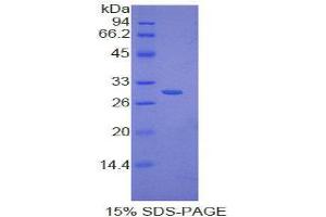 SDS-PAGE (SDS) image for Inhibitory Subunit of NF kappa B delta (IkBd) (AA 46-285) protein (His tag) (ABIN2125265)