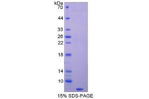 SDS-PAGE (SDS) image for Thymosin beta-4 (TMSB4X) (AA 1-44) protein (His tag) (ABIN1080915)