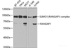 Western blot analysis of extracts of various cell lines using RANGAP1 Polyclonal Antibody at dilution of 1:1000. (RANGAP1 antibody)