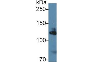 Western blot analysis of Human K562 cell lysate, using Mouse ADD1 Antibody (1 µg/ml) and HRP-conjugated Goat Anti-Rabbit antibody (