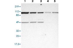 Western blot analysis of Lane 1: RT-4, Lane 2: EFO-21, Lane 3: A-431, Lane 4: Liver, Lane 5: Tonsil with ASCC2 polyclonal antibody  at 1:250-1:500 dilution. (ASCC2 antibody)