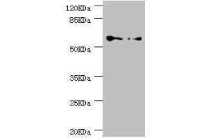 CCT5 抗体  (AA 1-270)